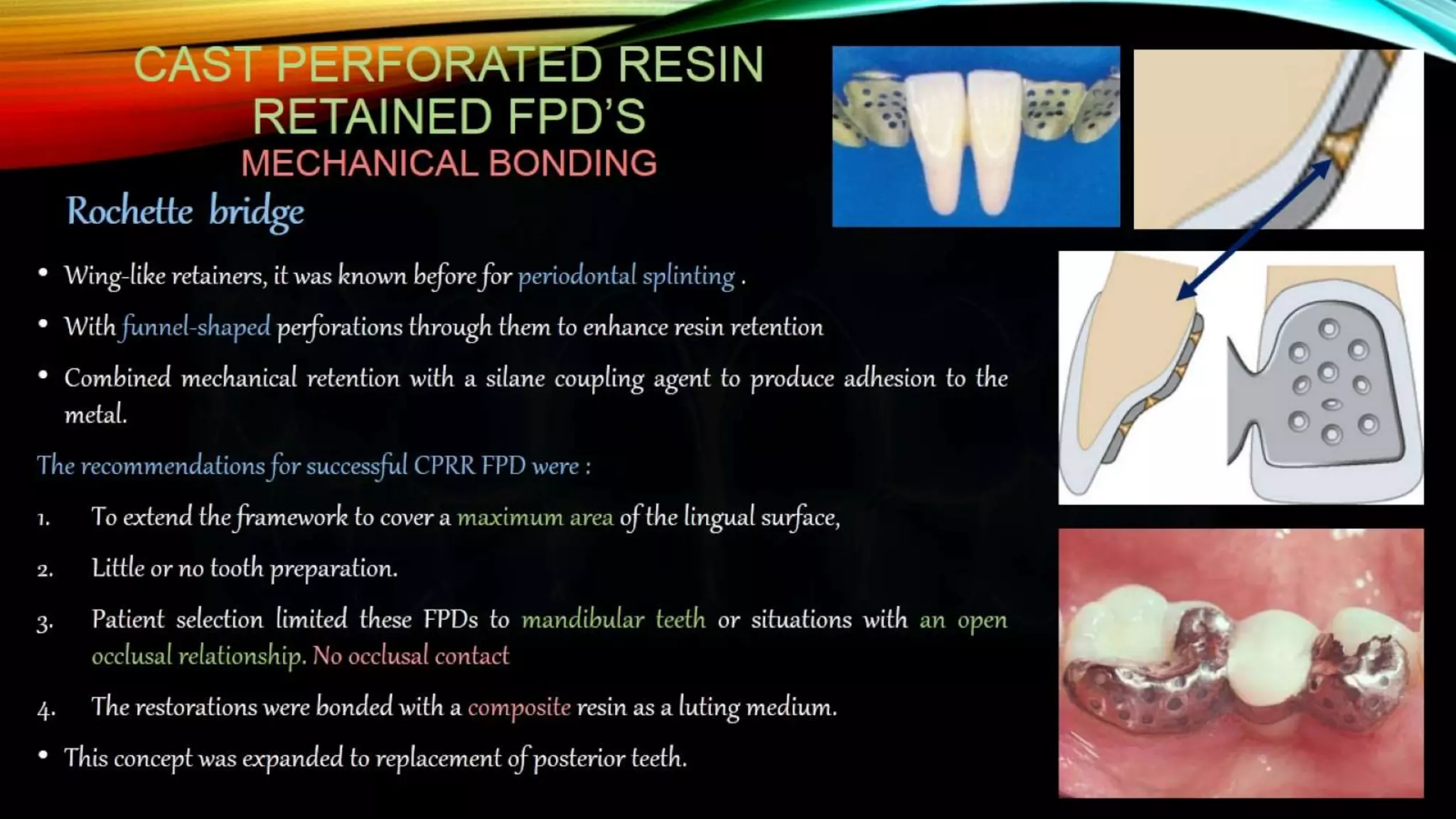 Anterior Resin bonded FPD | PPT