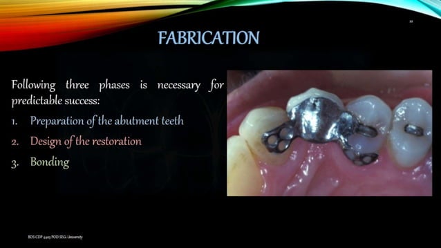 Anterior Resin bonded FPD | PPT