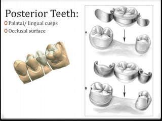 Posterior Teeth:
0 Palatal/ lingual cusps
0 Occlusal surface
 