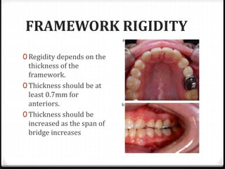 FRAMEWORK RIGIDITY
0 Regidity depends on the
thickness of the
framework.
0 Thickness should be at
least 0.7mm for
anteriors.
0 Thickness should be
increased as the span of
bridge increases
 