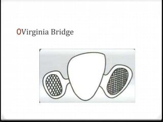 0Virginia Bridge
 