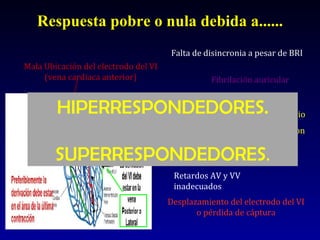 Respuesta pobre o nula debida a...... Desplazamiento del electrodo del VI o pérdida de cáptura Mala Ubicación del electrodo del VI (vena cardiaca anterior) Falta de disincronia a pesar de BRI Area extensa de Cicatriz de IM previo (El miocardio en el area de extension del VI debe ser capaz de contraerse). Fibrilación auricular Retardos AV y VV inadecuados HIPERRESPONDEDORES. SUPERRESPONDEDORES . 