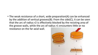 • The weak resistance of a short, wide preparation(A) can be enhanced
by the addition of vertical grooves(B). From the sid...