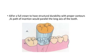 • A)For a full crown to have structural durability with proper contours
,its path of insertion would parallel the long axi...