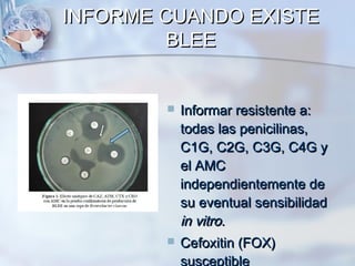 INFORME CUANDO EXISTE
         BLEE


           Informar resistente a:
            todas las penicilinas,
            C1G, C2G, C3G, C4G y
            el AMC
            independientemente de
            su eventual sensibilidad
            in vitro.
           Cefoxitin (FOX)
            susceptible
 