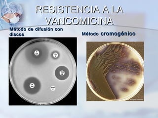 RESISTENCIA A LA
           VANCOMICINA
Método de difusión con
discos                   Método cromogénico
 