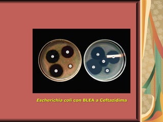 Escherichia coli  con BLEA a Ceftazidima 