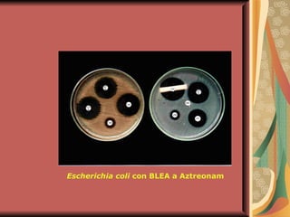 Escherichia coli  con BLEA a Aztreonam 