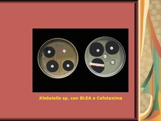 Klebsiella  sp. con BLEA a Cefotaxima 