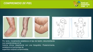 COMPROMISO DE PIEL
Por tanto, inicialmente establezca el tipo de lesión, documentando
sus características en la
historia clínica (idealmente con una fotografía). Posteriormente,
establezca el porcentaje de
superficie corporal comprometida,
 