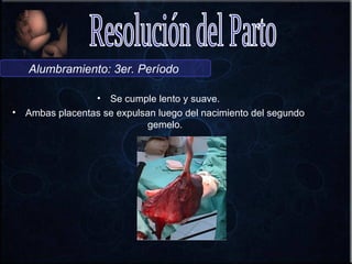 Alumbramiento: 3er. Período

                   • Se cumple lento y suave.
•   Ambas placentas se expulsan luego del nacimiento del segundo
                             gemelo.
 