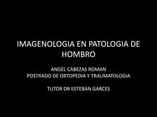IMAGENOLOGIA EN PATOLOGIA DE 
HOMBRO 
ANGEL CABEZAS ROMAN 
POSTRADO DE ORTOPEDIA Y TRAUMATOLOGIA 
TUTOR DR ESTEBAN GARCES 
 