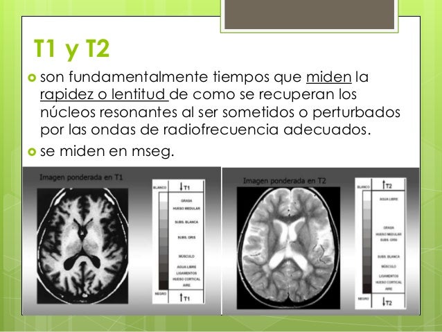 Resonancia magnetica Resonancia magnetica
