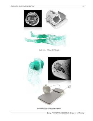 CAPÍTULO X: RESONANCIA MAGNÉTICA 117
Bioing. PEDRO PABLO ESCOBAR – Imágenes en Medicina.
KNEE COIL – BOBINA DE RODILLA
SHOULDER COIL – BOBINA DE HOMBRO
 