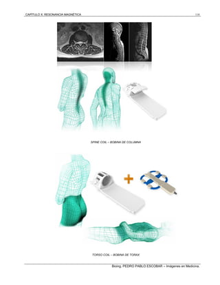 CAPÍTULO X: RESONANCIA MAGNÉTICA 118
Bioing. PEDRO PABLO ESCOBAR – Imágenes en Medicina.
SPINE COIL – BOBINA DE COLUMNA
TORSO COIL – BOBINA DE TORAX
 