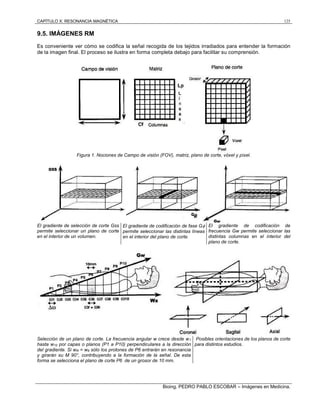 CAPÍTULO X: RESONANCIA MAGNÉTICA 125
Bioing. PEDRO PABLO ESCOBAR – Imágenes en Medicina.
9.5. IMÁGENES RM
Es conveniente ver cómo se codifica la señal recogida de los tejidos irradiados para entender la formación
de la imagen final. El proceso se ilustra en forma completa debajo para facilitar su comprensión.
Figura 1. Nociones de Campo de visión (FOV), matriz, plano de corte, vóxel y píxel.
El gradiente de selección de corte Gss
permite seleccionar un plano de corte
en el interior de un volumen.
El gradiente de codificación de fase G
permite seleccionar las distintas líneas
en el interior del plano de corte.
El gradiente de codificación de
frecuencia Gw permite seleccionar las
distintas columnas en el interior del
plano de corte.
Selección de un plano de corte. La frecuencia angular w crece desde w1
hasta w10 por capas o planos (P1 a P10) perpendiculares a la dirección
del gradiente. Si wR = w6 sólo los protones de P6 entrarán en resonancia
y girarán su M 90°, contribuyendo a la formación de la señal. De esta
forma se selecciona el plano de corte P6 de un grosor de 10 mm.
Posibles orientaciones de los planos de corte
para distintos estudios.
 