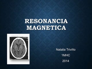 RESONANCIA
MAGNETICA
Natalia Triviño
1MHC
2014
 
