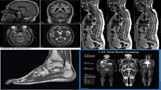 Resonancia magnetica