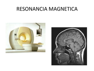 RESONANCIA MAGNETICA
 