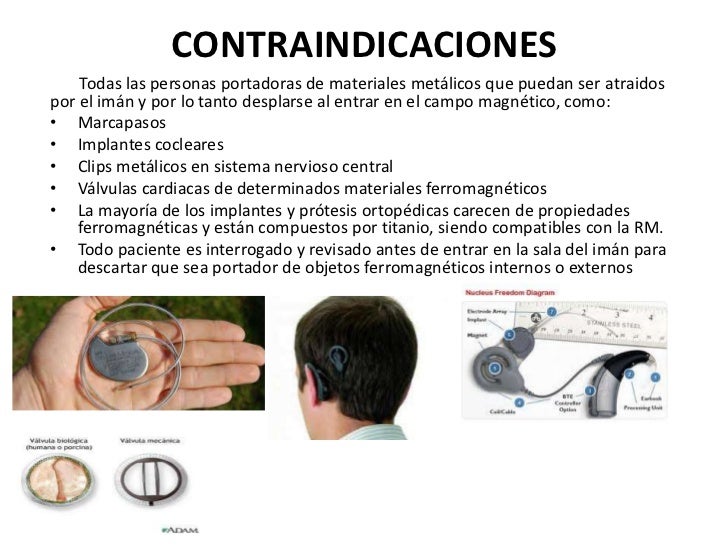 Resonancia magneticaexpo. Resonancia magneticaexpo.
