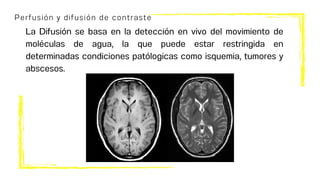 Perfusión y difusión de contraste
La Difusión se basa en la detección en vivo del movimiento de
moléculas de agua, la que puede estar restringida en
determinadas condiciones patólogicas como isquemia, tumores y
abscesos.
 