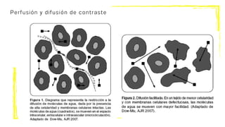Perfusión y difusión de contraste
 