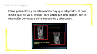 Calidad de Imagen
Estos parámetros y su interrelación hay que adaptarlos al caso
clínico que se va a evaluar para conseguir una imagen con la
resolución, contraste y señal necesarios y adecuados.
 