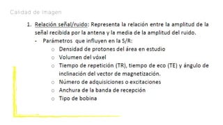 Calidad de Imagen
 
