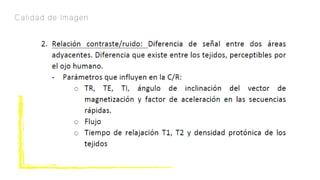 Calidad de Imagen
 