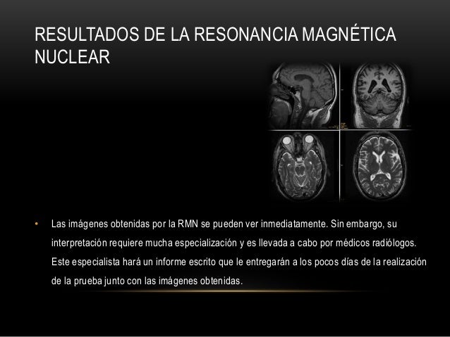 Resonancia magnetica