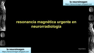 la neuroimagen
https://laneuroimagen.blogspot.com
la neuroimagen
https://laneuroimagen.blogspot.com
miguel blanco
resonancia magnética urgente en
neurorradiología
 