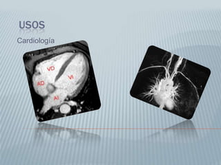 Los tiempos de relajación (TI y T2), son fundamentalmente tiempos que miden la rapidez o lentitud de como se recuperan los núcleos resonantes al ser sometidos o perturbados por las ondas de radiofrecuencia adecuados. 
