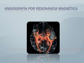 Imagen en T1                                 Imagen en T2