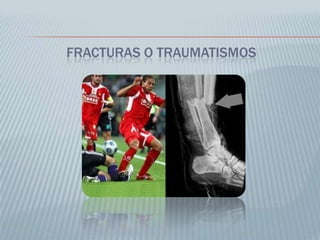 Angiografía por resonancia magnética