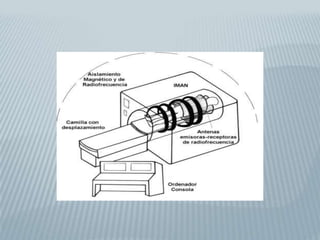   Antena receptora: Donde se recoge la señal.
