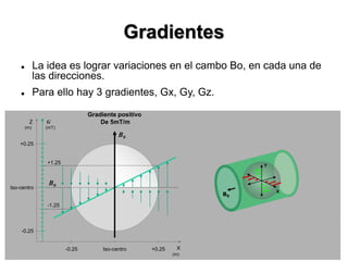 Gradientes
 La idea es lograr variaciones en el cambo Bo, en cada una de
las direcciones.
 Para ello hay 3 gradientes, Gx, Gy, Gz.
X
B0
B0
Gradiente positivo
De 5mT/mZ
Iso-centro-0.25 +0.25
-0.25
+0.25
Iso-centro
(mT)
-1.25
+1.25
G
(m)
(m)
B0
Y
X
 