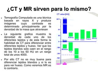 ¿CT y MR sirven para lo mismo?
 Tomografía Computada es una técnica
basada en rayos X y produce
imágenes cuyo contraste es
determinado principalmente por la
densidad de la masa que atraviesan
 La siguiente grafica muestra la
densidad de cada uno de los
diferentes tejidos y de esta forma la
habilidad de CT para diferenciar entre
diferentes tejidos y hueso. Ver que los
tejidos blandos solo caen en el rango
de los 10 a los 60 HU en un rango
total de unos 4000.
 Por ello CT no es muy buena para
diferenciar tejidos blandos y si lo es
para ver hueso. Como veremos MR es
lo contrario.
 