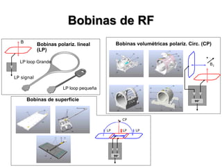Bobinas de RF
LP loop Grande
LP loop pequeña
LP signal
B
Bobinas polariz. lineal
(LP)
Bobinas volumétricas polariz. Circ. (CP)
B1
90°Bobinas de superficie
90°
LP LP LP
CP
 