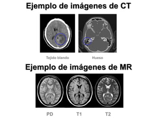 Ejemplo de imágenes de CT
Tejido blando Hueso
T2T1PD
Ejemplo de imágenes de MR
 