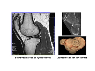 Buena visualización de tejidos blandos Las fracturas se ven con claridad
 
