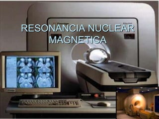 RESONANCIA NUCLEAR
    MAGNETICA
 