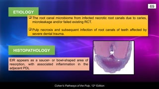 Resorption Nupur.pptx important for dental students | PPTX
