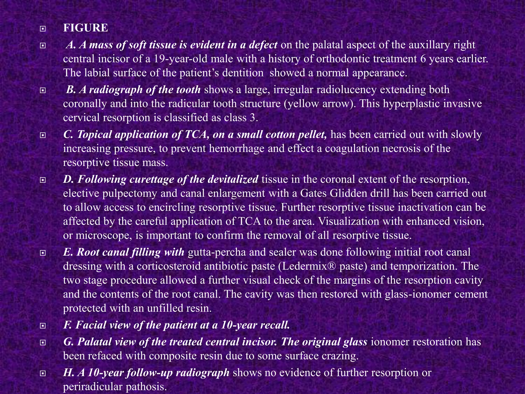  FIGURE
 A. A mass of soft tissue is evident in a defect on the palatal aspect of the auxillary right
central incisor of a 19-year-old male with a history of orthodontic treatment 6 years earlier.
The labial surface of the patient’s dentition showed a normal appearance.
 B. A radiograph of the tooth shows a large, irregular radiolucency extending both
coronally and into the radicular tooth structure (yellow arrow). This hyperplastic invasive
cervical resorption is classified as class 3.
 C. Topical application of TCA, on a small cotton pellet, has been carried out with slowly
increasing pressure, to prevent hemorrhage and effect a coagulation necrosis of the
resorptive tissue mass.
 D. Following curettage of the devitalized tissue in the coronal extent of the resorption,
elective pulpectomy and canal enlargement with a Gates Glidden drill has been carried out
to allow access to encircling resorptive tissue. Further resorptive tissue inactivation can be
affected by the careful application of TCA to the area. Visualization with enhanced vision,
or microscope, is important to confirm the removal of all resorptive tissue.
 E. Root canal filling with gutta-percha and sealer was done following initial root canal
dressing with a corticosteroid antibiotic paste (Ledermix® paste) and temporization. The
two stage procedure allowed a further visual check of the margins of the resorption cavity
and the contents of the root canal. The cavity was then restored with glass-ionomer cement
protected with an unfilled resin.
 F. Facial view of the patient at a 10-year recall.
 G. Palatal view of the treated central incisor. The original glass ionomer restoration has
been refaced with composite resin due to some surface crazing.
 H. A 10-year follow-up radiograph shows no evidence of further resorption or
periradicular pathosis.
 