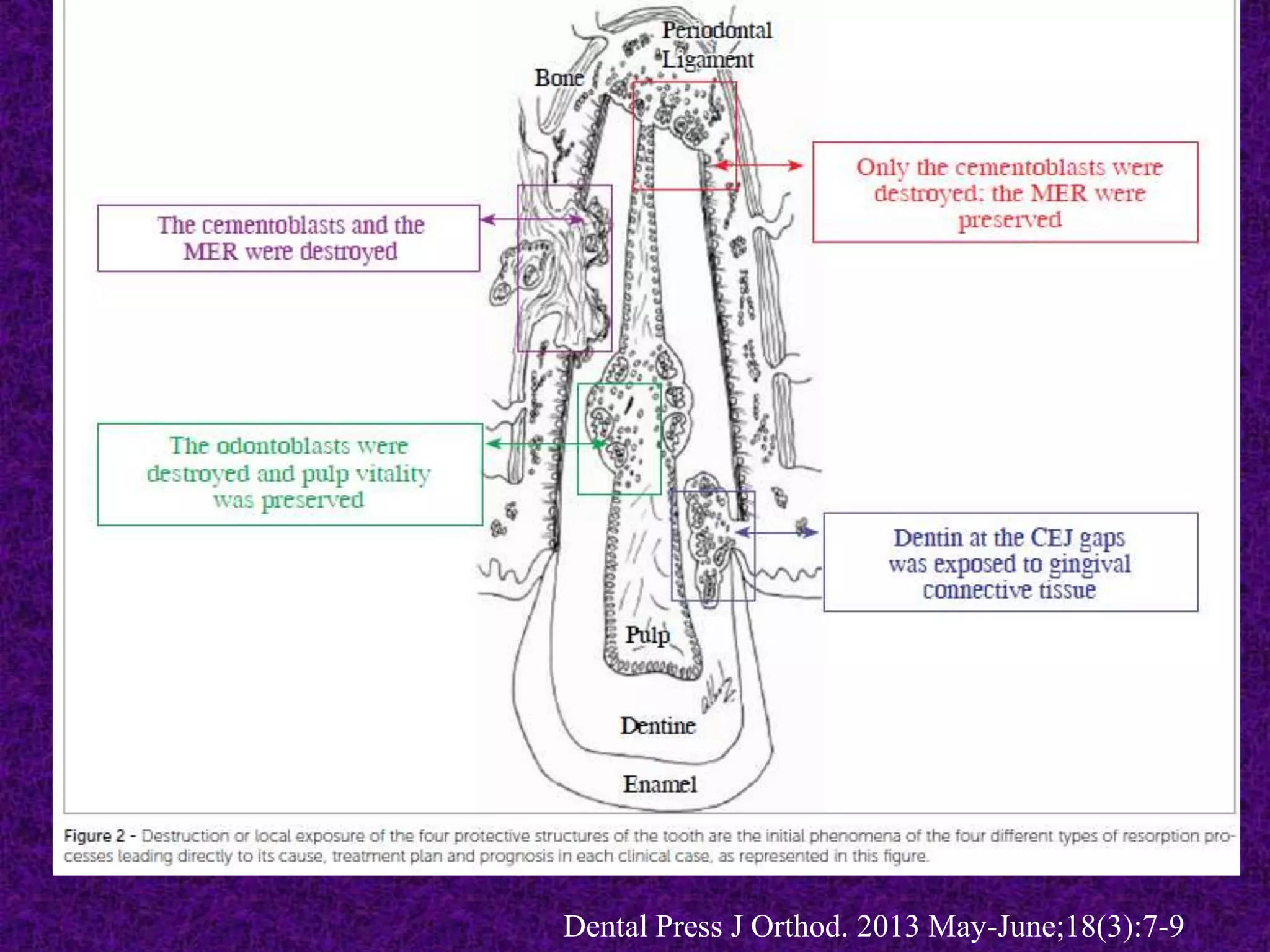 Dental Press J Orthod. 2013 May-June;18(3):7-9
 