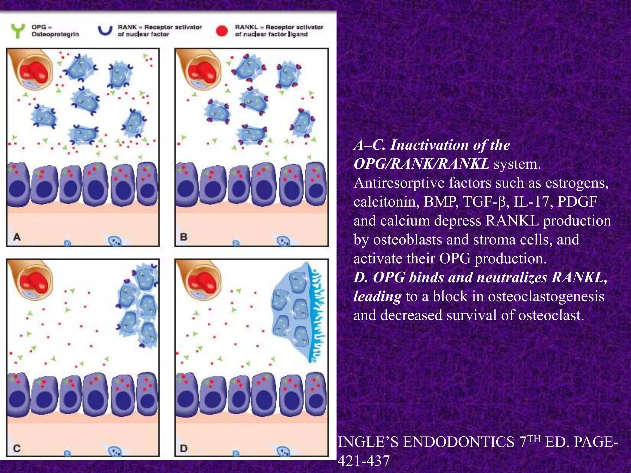 A–C. Inactivation of the
OPG/RANK/RANKL system.
Antiresorptive factors such as estrogens,
calcitonin, BMP, TGF-β, IL-17, PDGF
and calcium depress RANKL production
by osteoblasts and stroma cells, and
activate their OPG production.
D. OPG binds and neutralizes RANKL,
leading to a block in osteoclastogenesis
and decreased survival of osteoclast.
INGLE’S ENDODONTICS 7TH ED. PAGE-
421-437
 