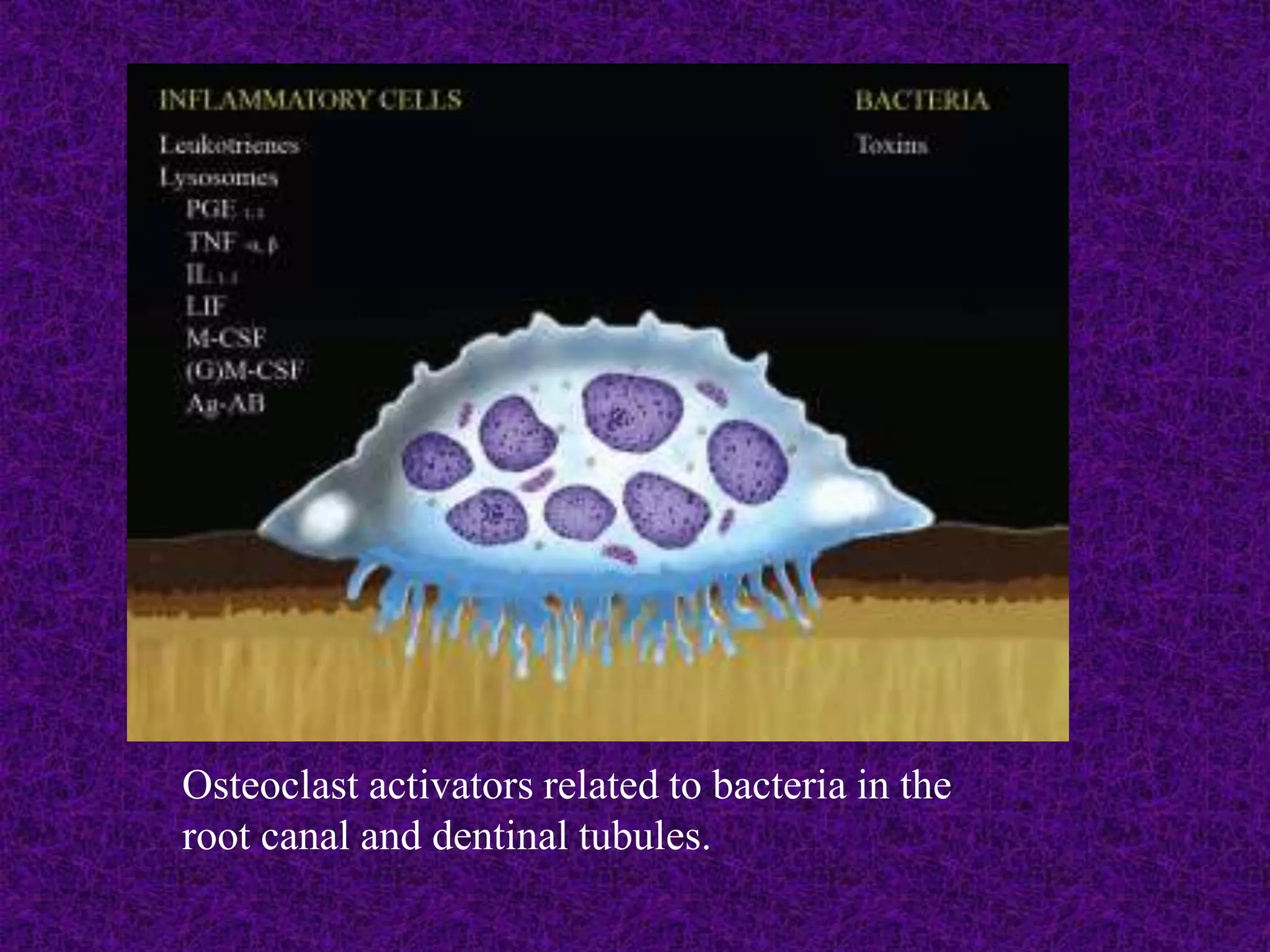 Osteoclast activators related to bacteria in the
root canal and dentinal tubules.
 