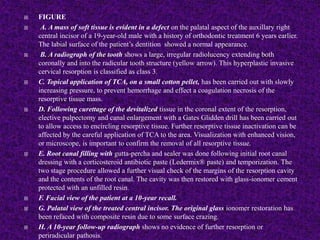  FIGURE
 A. A mass of soft tissue is evident in a defect on the palatal aspect of the auxillary right
central incisor of a 19-year-old male with a history of orthodontic treatment 6 years earlier.
The labial surface of the patient’s dentition showed a normal appearance.
 B. A radiograph of the tooth shows a large, irregular radiolucency extending both
coronally and into the radicular tooth structure (yellow arrow). This hyperplastic invasive
cervical resorption is classified as class 3.
 C. Topical application of TCA, on a small cotton pellet, has been carried out with slowly
increasing pressure, to prevent hemorrhage and effect a coagulation necrosis of the
resorptive tissue mass.
 D. Following curettage of the devitalized tissue in the coronal extent of the resorption,
elective pulpectomy and canal enlargement with a Gates Glidden drill has been carried out
to allow access to encircling resorptive tissue. Further resorptive tissue inactivation can be
affected by the careful application of TCA to the area. Visualization with enhanced vision,
or microscope, is important to confirm the removal of all resorptive tissue.
 E. Root canal filling with gutta-percha and sealer was done following initial root canal
dressing with a corticosteroid antibiotic paste (Ledermix® paste) and temporization. The
two stage procedure allowed a further visual check of the margins of the resorption cavity
and the contents of the root canal. The cavity was then restored with glass-ionomer cement
protected with an unfilled resin.
 F. Facial view of the patient at a 10-year recall.
 G. Palatal view of the treated central incisor. The original glass ionomer restoration has
been refaced with composite resin due to some surface crazing.
 H. A 10-year follow-up radiograph shows no evidence of further resorption or
periradicular pathosis.
 