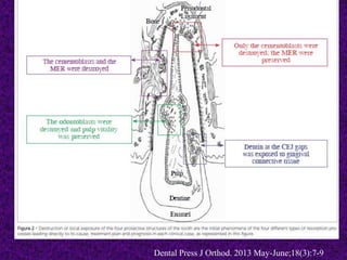 Dental Press J Orthod. 2013 May-June;18(3):7-9
 