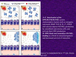A–C. Inactivation of the
OPG/RANK/RANKL system.
Antiresorptive factors such as estrogens,
calcitonin, BMP, TGF-β, IL-17, PDGF
and calcium depress RANKL production
by osteoblasts and stroma cells, and
activate their OPG production.
D. OPG binds and neutralizes RANKL,
leading to a block in osteoclastogenesis
and decreased survival of osteoclast.
INGLE’S ENDODONTICS 7TH ED. PAGE-
421-437
 