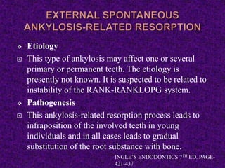 Etiology
 This type of ankylosis may affect one or several
primary or permanent teeth. The etiology is
presently not known. It is suspected to be related to
instability of the RANK-RANKLOPG system.
 Pathogenesis
 This ankylosis-related resorption process leads to
infraposition of the involved teeth in young
individuals and in all cases leads to gradual
substitution of the root substance with bone.
INGLE’S ENDODONTICS 7TH ED. PAGE-
421-437
 